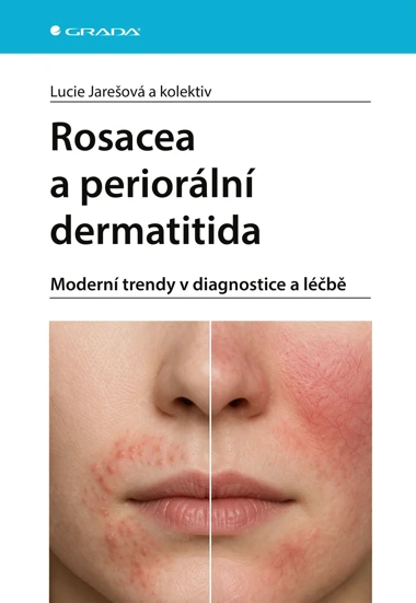 Rosacea a periorální dermatitida